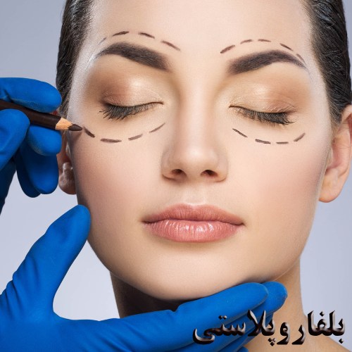 بلفاروپلاستی