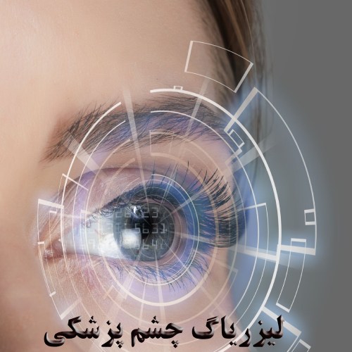 کاربرد لیزر یاگ