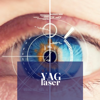 Yag laser